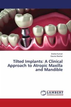 Tilted Implants: A Clinical Approach to Atropic Maxilla and Mandible - Kumari, Sneha;Beohar, Gaurav