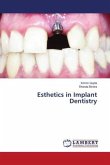 Esthetics in Implant Dentistry