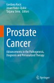 Prostate Cancer Prostate Cancer