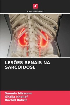 LESÕES RENAIS NA SARCOIDOSE - MISSOUM, Soumia;KHELLAF, Ghalia;Bahriz, Rachid