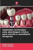 Implantes inclinados: uma abordagem clínica para maxila e mandíbula atrópicas