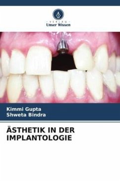 ÄSTHETIK IN DER IMPLANTOLOGIE - Gupta, Kimmi;Bindra, Shweta