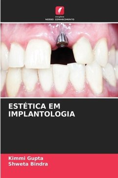 ESTÉTICA EM IMPLANTOLOGIA - Gupta, Kimmi;Bindra, Shweta