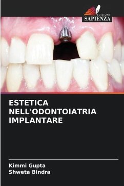 ESTETICA NELL'ODONTOIATRIA IMPLANTARE - Gupta, Kimmi;Bindra, Shweta