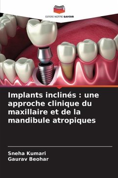 Implants inclinés : une approche clinique du maxillaire et de la mandibule atropiques - Kumari, Sneha;Beohar, Gaurav