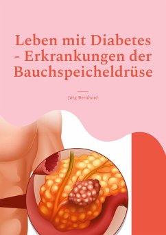 Leben mit Diabetes - Erkrankungen der Bauchspeicheldrüse (eBook, ePUB)