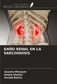 Cover DAÑO RENAL EN LA SARCOIDOSIS