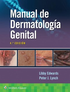 Manual de dermatologia genital - Lynch, Peter; Edwards, Elizabeth