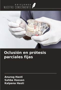 Cover Oclusión en prótesis parciales fijas