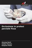 Occlusione in protesi parziale fissa