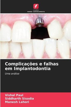 Complicações e falhas em Implantodontia - Paul, Vishal;Sisodia, Siddharth;Lahori, Manesh