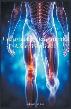 Understanding Osteoarthritis - Hajbabaie, Pejman