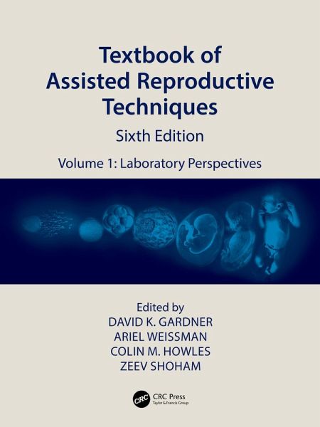 Textbook of Assisted Reproductive Techniques (eBook, PDF) Textbook of Assisted Reproductive Techniques (eBook, PDF)