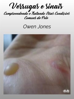 Verrugas E Sinais (eBook, ePUB) - Jones, Owen