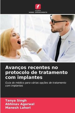 Avanços recentes no protocolo de tratamento com implantes - Singh, Tanya;Agarwal, Abhinav;Lahori, Manesh