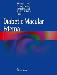 Diabetic Macular Edema