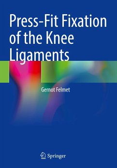 Press-Fit Fixation of the Knee Ligaments - Felmet, Gernot