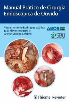 Manual Prático de Cirurgia Endoscópica de Ouvido (eBook, ePUB) - Silva, Vagner Antonio Rodrigues da; Nogueira Jr., João Flávio; Castilho, Arthur Menino