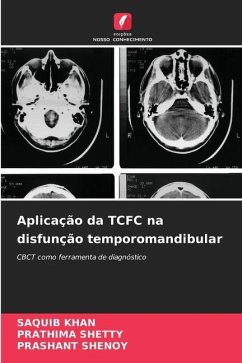 Aplicação da TCFC na disfunção temporomandibular - KHAN, SAQUIB;Shetty, Prathima;SHENOY, PRASHANT