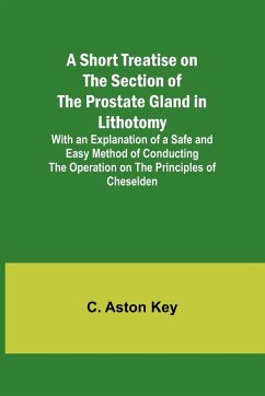 A Short Treatise on the Section of the Prostate Gland in Lithotomy;With an Explanation of a Safe and Easy Method of Conducting the Operation on the Principles of Cheselden - Key, C. Aston