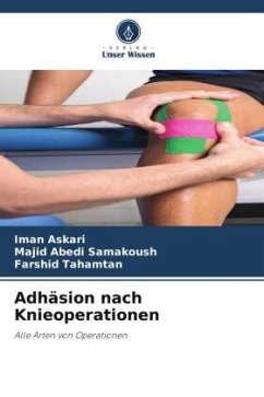 Adhäsion nach Knieoperationen - Askari, Iman;Samakoush, Majid Abedi;Tahamtan, Farshid