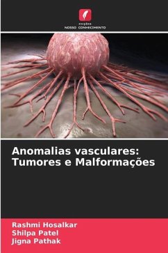 Anomalias vasculares: Tumores e Malformações - Hosalkar, Rashmi;Patel, Shilpa;Pathak, Jigna