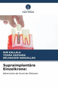 Supraimplantäre Einzelkrone: - Kallala, Rim;Gassara, Yosra;Harzallah, Belhassen