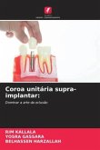 Coroa unitária supra-implantar: