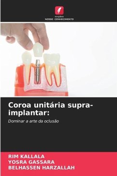 Coroa unitária supra-implantar: - Kallala, Rim;Gassara, Yosra;Harzallah, Belhassen