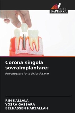 Corona singola sovraimplantare: - Kallala, Rim;Gassara, Yosra;Harzallah, Belhassen