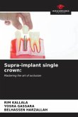 Supra-implant single crown: