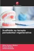 Scaffolds na terapia periodontal regenerativa