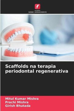 Scaffolds na terapia periodontal regenerativa - Mishra, Mitul Kumar;Mishra, Prachi;Bhutada, Girish