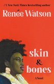 skin & bones (eBook, ePUB)