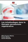 Les échafaudages dans la thérapie parodontale régénérative