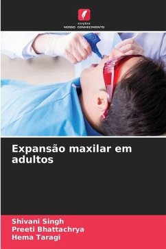 Expansão maxilar em adultos - Singh, Shivani;Bhattachrya, Preeti;Taragi, Hema