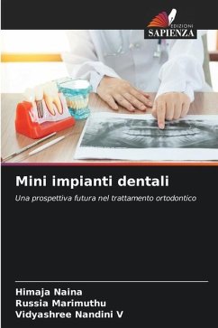 Mini impianti dentali - Naina, Himaja;Marimuthu, Russia;Nandini V, Vidyashree
