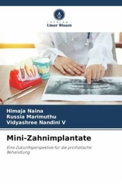 Mini-Zahnimplantate - Naina, Himaja;Marimuthu, Russia;Nandini V, Vidyashree