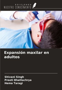 Expansión maxilar en adultos Cover Expansión maxilar en adultos