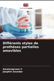 Différents styles de prothèses partielles amovibles