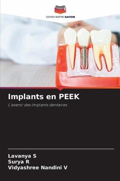 Implants en PEEK - S, Lavanya;R, Surya;Nandini V, Vidyashree