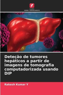 Deteção de tumores hepáticos a partir de imagens de tomografia computadorizada usando DIP - Y, Rakesh Kumar