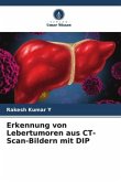 Erkennung von Lebertumoren aus CT-Scan-Bildern mit DIP