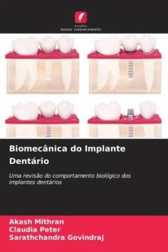 Biomecânica do Implante Dentário - Mithran, Akash;Peter, Claudia;GOVINDRAJ, Sarathchandra