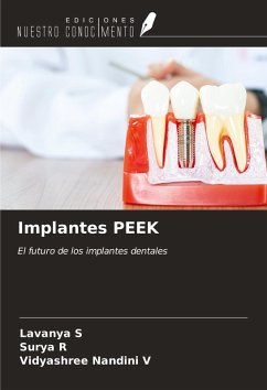 Cover Implantes PEEK