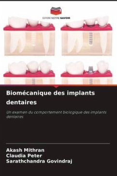 Biomécanique des implants dentaires - Mithran, Akash;Peter, Claudia;GOVINDRAJ, Sarathchandra