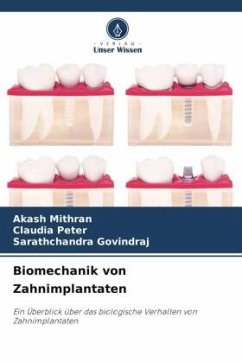 Biomechanik von Zahnimplantaten - Mithran, Akash;Peter, Claudia;GOVINDRAJ, Sarathchandra