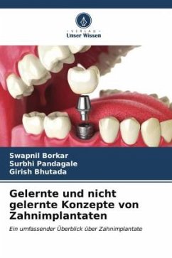 Gelernte und nicht gelernte Konzepte von Zahnimplantaten - Borkar, Swapnil;Pandagale, Surbhi;Bhutada, Girish