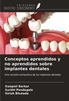 Cover Conceptos aprendidos y no aprendidos sobre implantes dentales