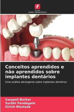 Conceitos aprendidos e não aprendidos sobre implantes dentários - Borkar, Swapnil;Pandagale, Surbhi;Bhutada, Girish